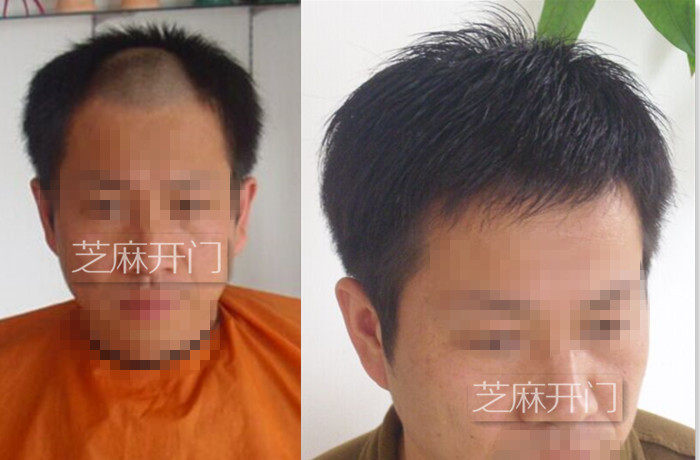 Extension mèches - Ref 224331 Image 17