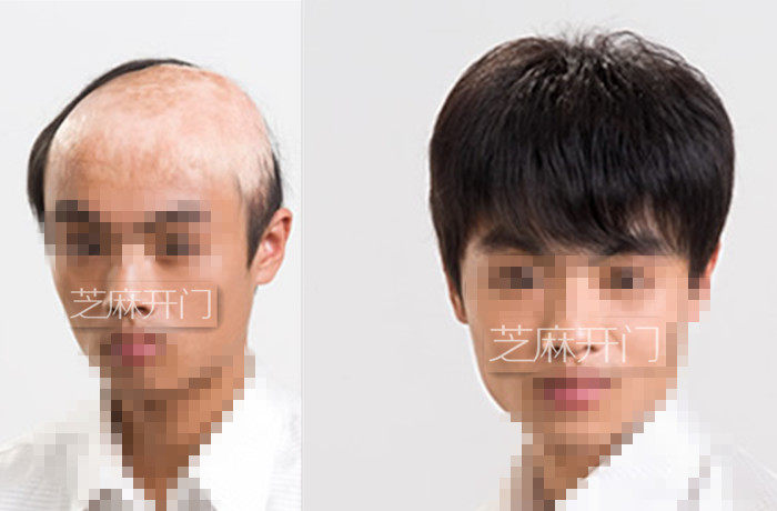 Extension mèches - Ref 224331 Image 21