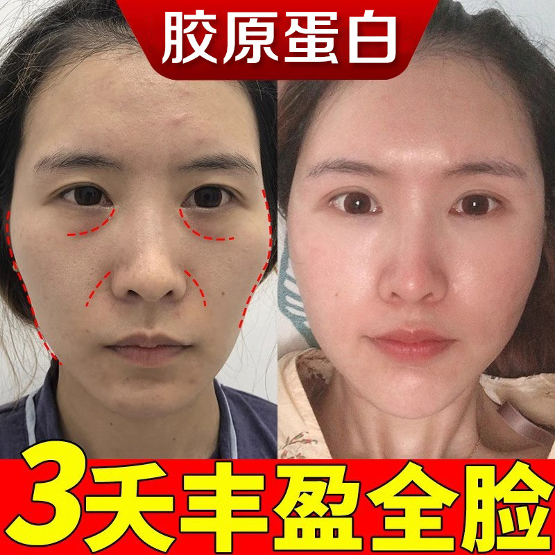 Type 3 Collagen Original Liquid Essence for Plumping and Firming the Face, Anti-Wrinkle, Lifting, and Non-Anti-Aging Wrinkle-Removing Essence Flagship