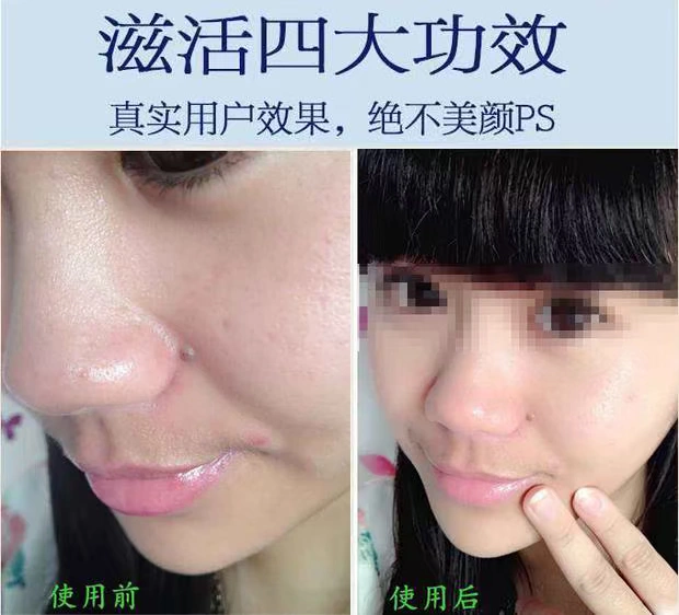 Chính thức xác thực nuôi dưỡng trẻ hóa da mặt độc tố massage mặt kem kem làm sạch sâu lỗ chân lông