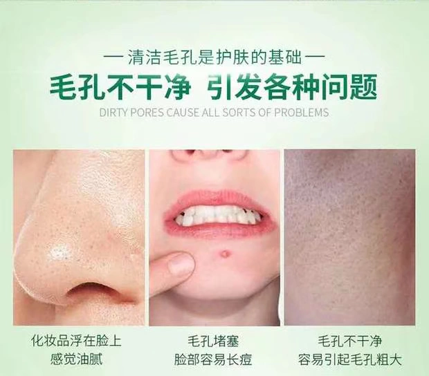 Chính thức xác thực nuôi dưỡng trẻ hóa da mặt độc tố massage mặt kem kem làm sạch sâu lỗ chân lông