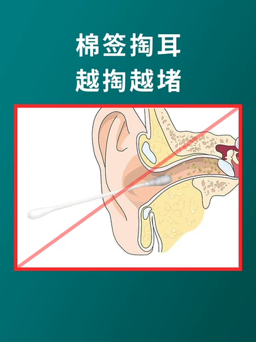 Ухочистка из нержавеющей стали, гигиенический набор инструментов для ушей, массажер для домашнего использования