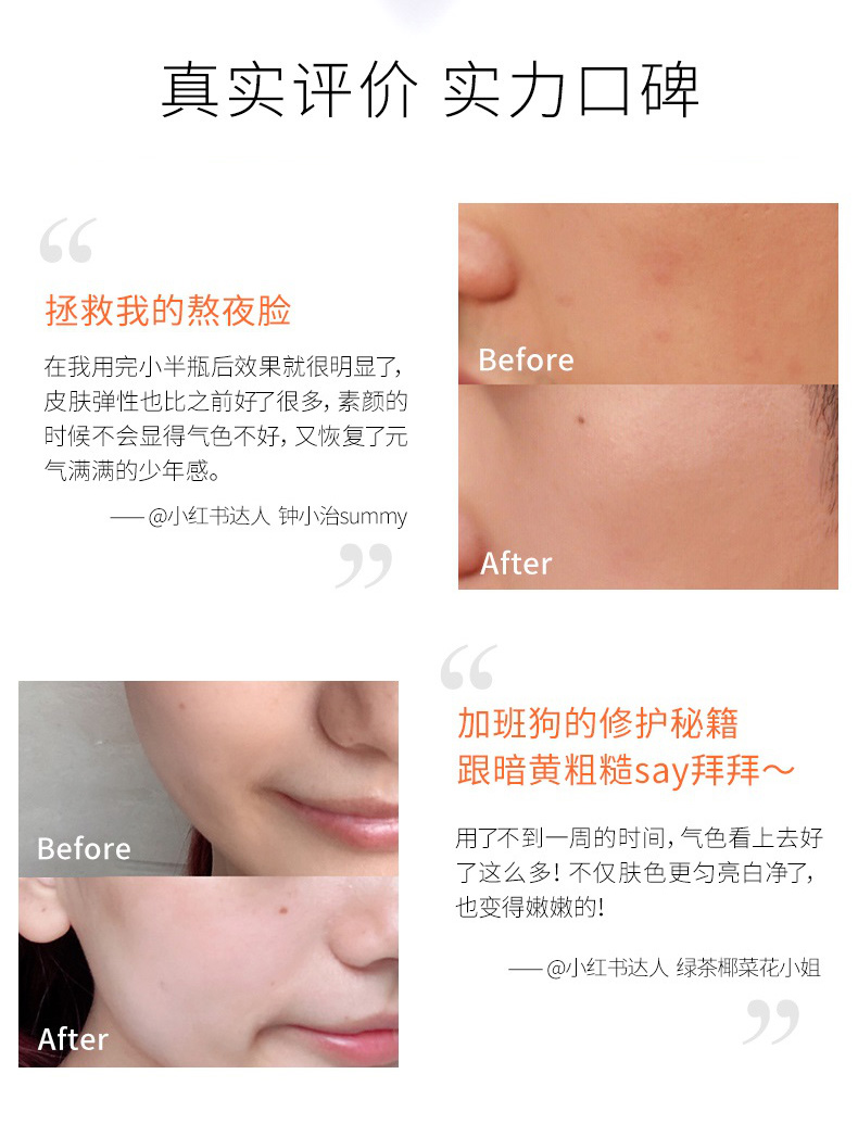 薇娅推荐 BM 肌活虾青素肌底精华液 图1