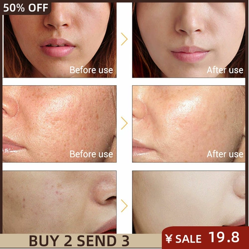 Отбеливание витамина С отбеливающего лица в сыворотке крови осветление