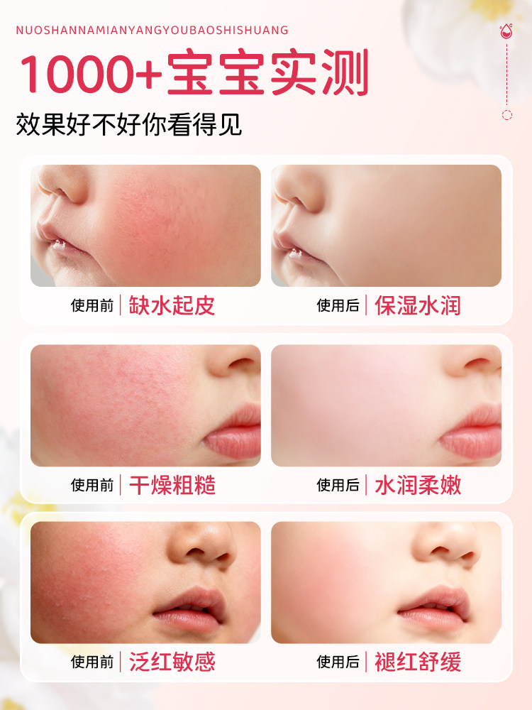 100% Australian Imported Sheep Oil Children's Face Cream Moisturizing and Nourishing Baby Cream Infant Lanolin Cream Moisturizing Lotion Genuine