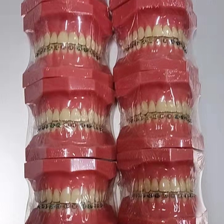 牙科口腔隐形正畸模型保持器示范钢丝透明牙套隐形矫正示范牙模