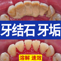  Remove calculus dissolve calculus quick-acting tartar remover oral cleaning tooth cleaning yellow removal artifact toothpaste tool