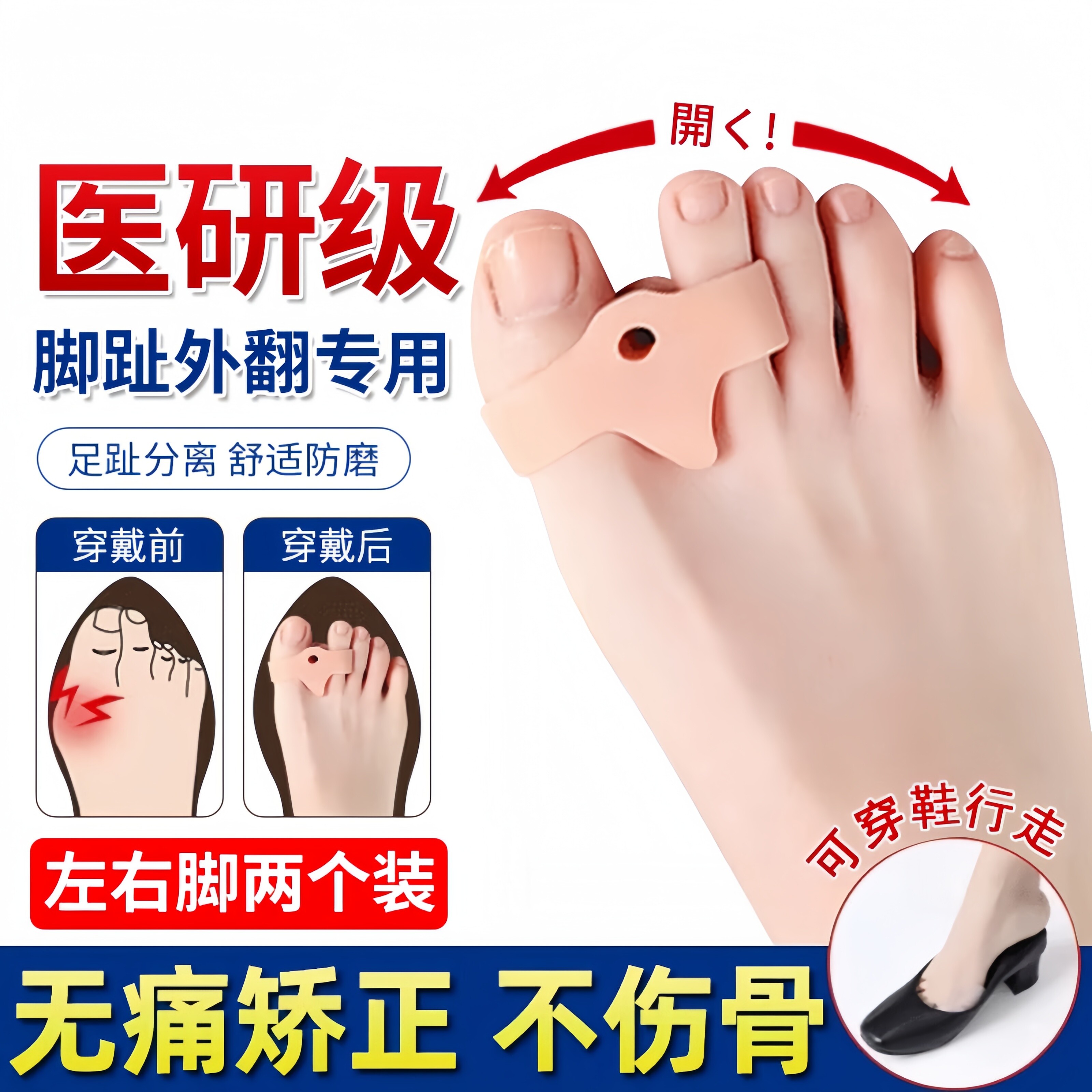 医用大母脚趾外翻矫正器指甲内扣弯曲纠正女士脚趾骨分趾器可穿鞋