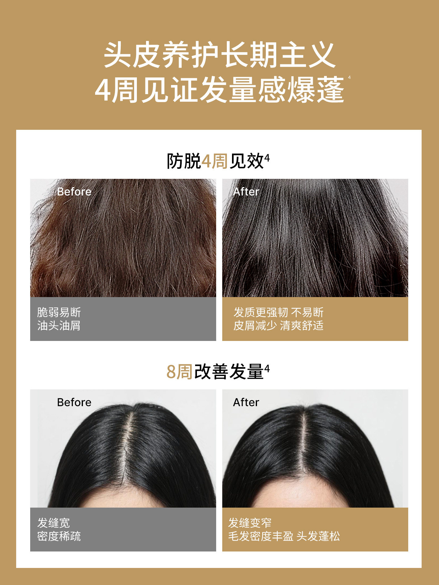 Left Point Anti-Hair Loss Scalp Care Essence for Men and Women, Hair Strengthening and Anti-Hair Loss Hair Care Scalp Care Solution