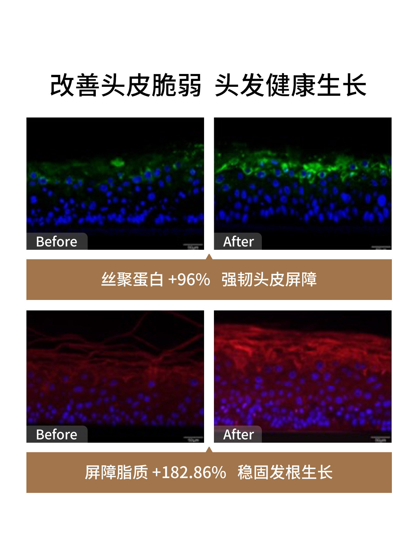 Left Point Anti-Hair Loss Scalp Care Essence for Men and Women, Hair Strengthening and Anti-Hair Loss Hair Care Scalp Care Solution