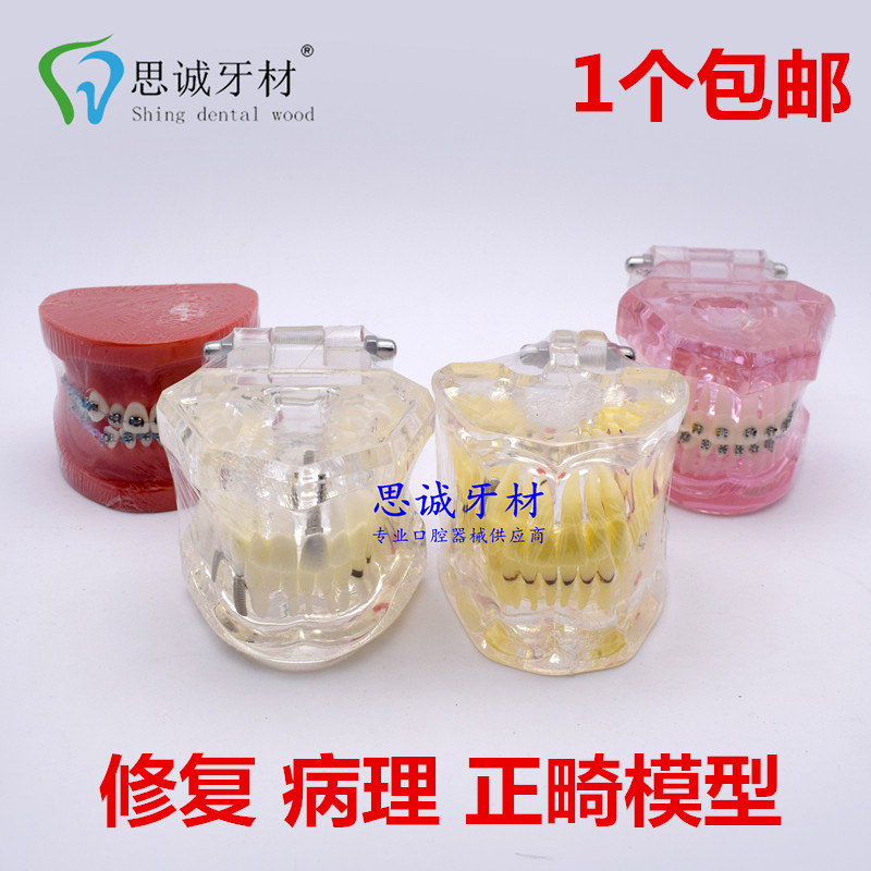 牙齿模型教学模型牙科材料口腔材料假牙模型口腔模型病理修复模型