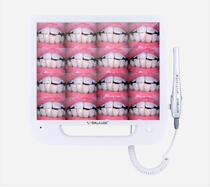 HD oral camera all-in-one dental camera all-in-one dental camera