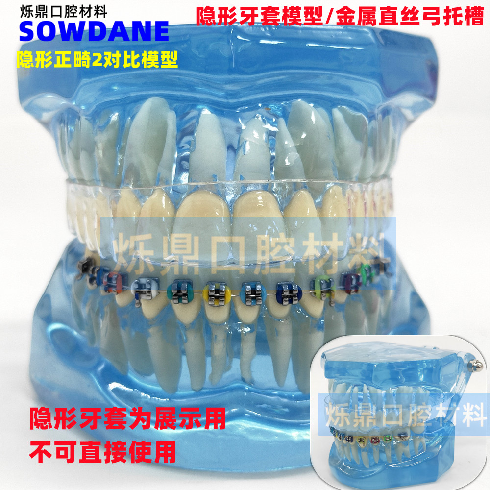 牙科牙模型隐形正畸模型医患沟通讲解教学模型正畸2对比模型