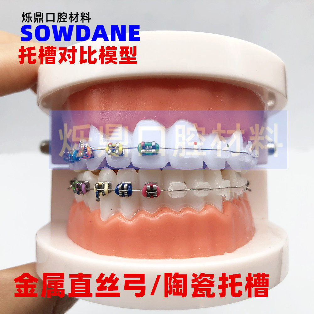 牙科模型 金属/陶瓷正畸牙模型 全金属齿科 医患沟通 讲解