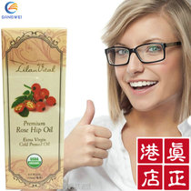Hong Kong Cosway Chile produced high-quality rosehip oil 93349 Acne scar good products to print rosehip oil