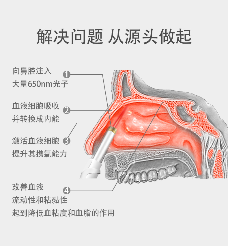药监局备案 光盾 鼻炎激光理疗仪 图5
