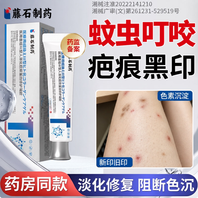 Mosquito Bite Scar Removal Cream, Scar Removal Cream, Black Mark Removal, Melanin Deposition Removal, Skin Scar Mark Repair on Legs, Medical Type Yz Mosquito Bite Scar Removal Cream, Scar Removal Cream, Black Mark Removal, Melanin Deposition Removal, Skin Scar Mark Repair on Legs, Medical Type Yz