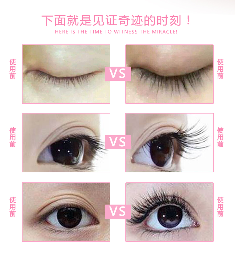 Nữ lông mi tăng trưởng chất lỏng nuôi dưỡng mascara quăn lâu dài dài màu đen dày không thấm nước lông mày tăng trưởng chất lỏng mascara ysl