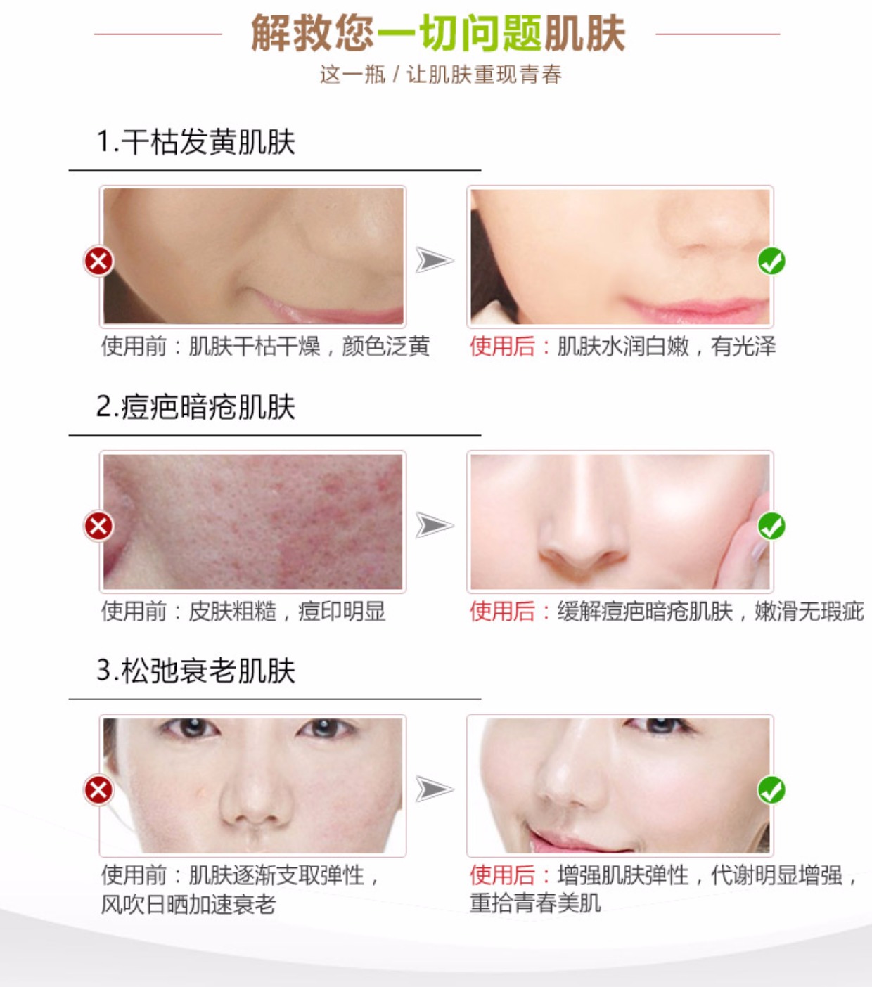 Tinh chất làm trắng da để loại bỏ mụn trứng cá tế bào gốc honesi