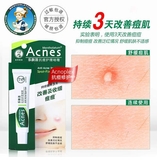 Mentholatum, лечебный гель, увлажняющая освежающая эссенция подходит для мужчин и женщин, анти-акне, 18г, контроль жирного блеска