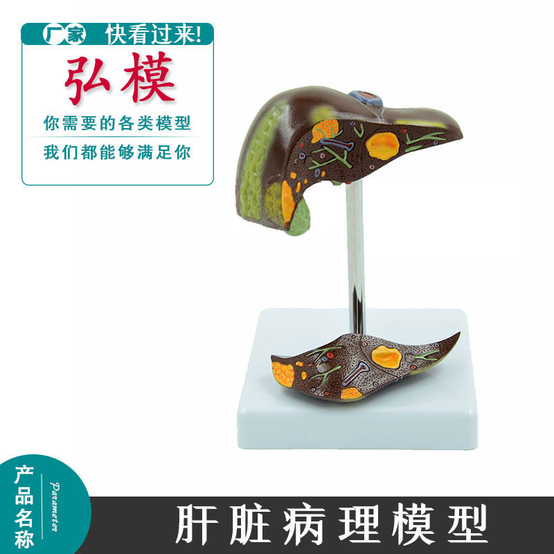 弘模肝脏病理模型 结石模型医用消化内科模型 仿真人体肝胆模型