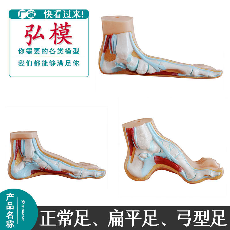 弘模 正常足扁平足弓型足的解剖结构及其胫骨末端的特征示教模型