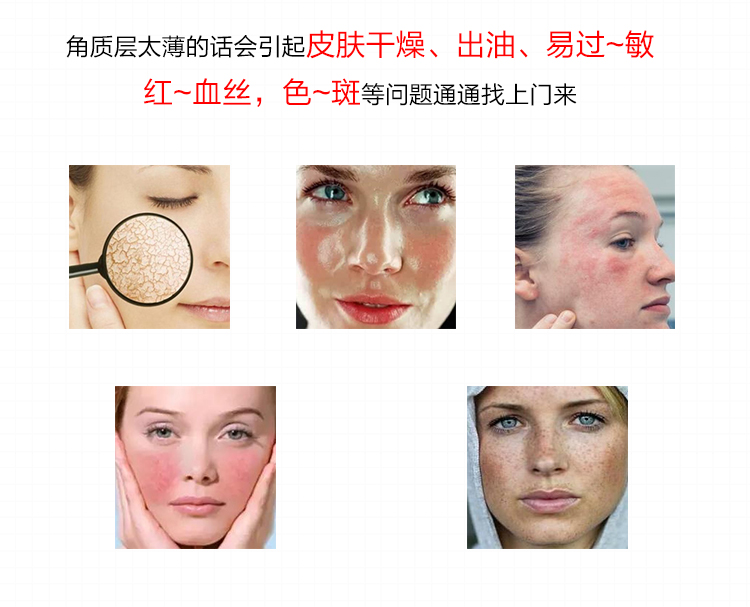 Tinh chất Nhật Bản ceramide nguyên chất huyết thanh nữ dưỡng ẩm làm dịu sửa chữa cơ nhạy cảm serum vàng