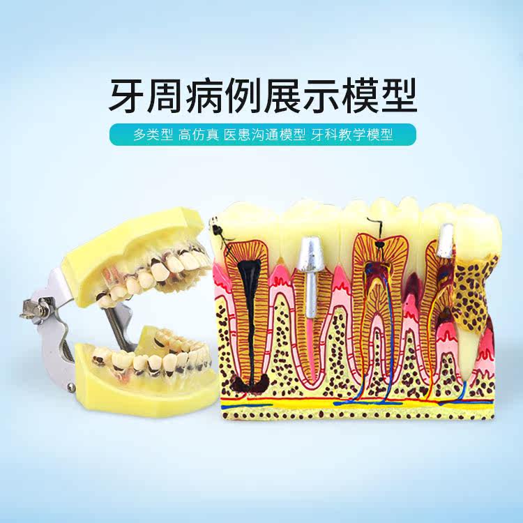 牙周病模型 牙龈根尖结石萎缩增生病变切开缝合龋坏 练习 牙科