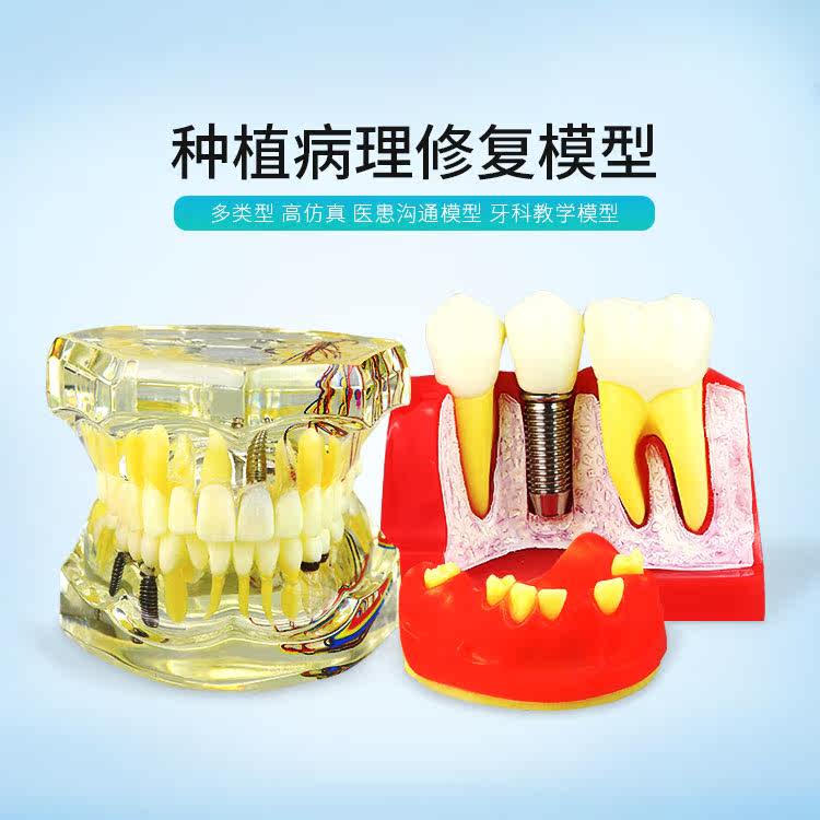 种植修复支抗钉植体骨块切开缝合仿骨质打孔上颌窦练习模型牙科