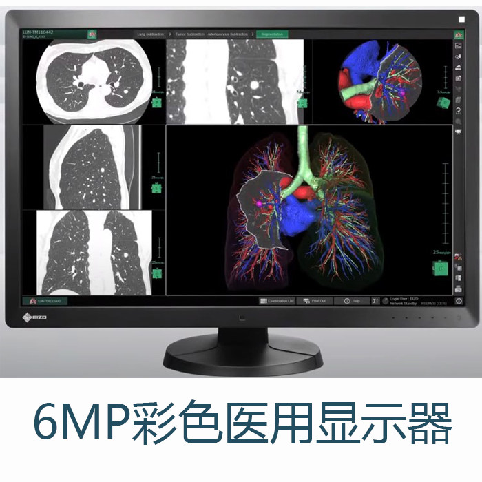 EIZO) global brand 8MP color medical monitor EV3285 3840X2160 any 4 screens