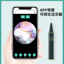 Home Visualization Ultrasonic Dentistry Dentistry TEETH Teeth Stones Beauty Toothometer Electric Cleaner Electric Cleaner WT WT