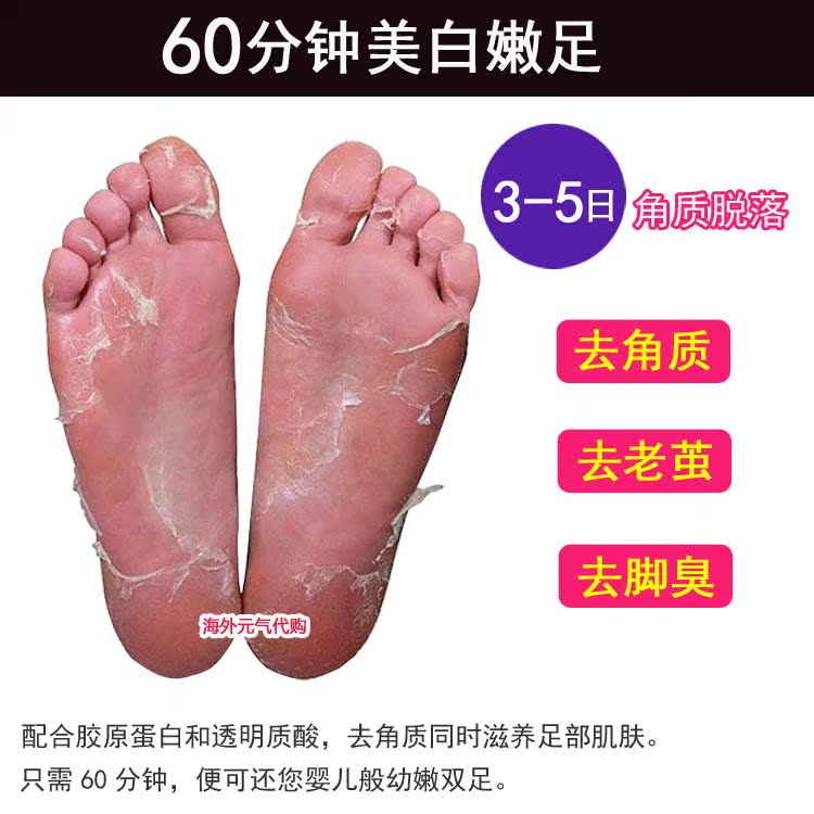 Nhật Bản để da chết sừng già phim hoa oải hương lột chân chăm sóc chân dịu dàng chân đẹp phim trắng chân thuốc trị nẻ gót chân