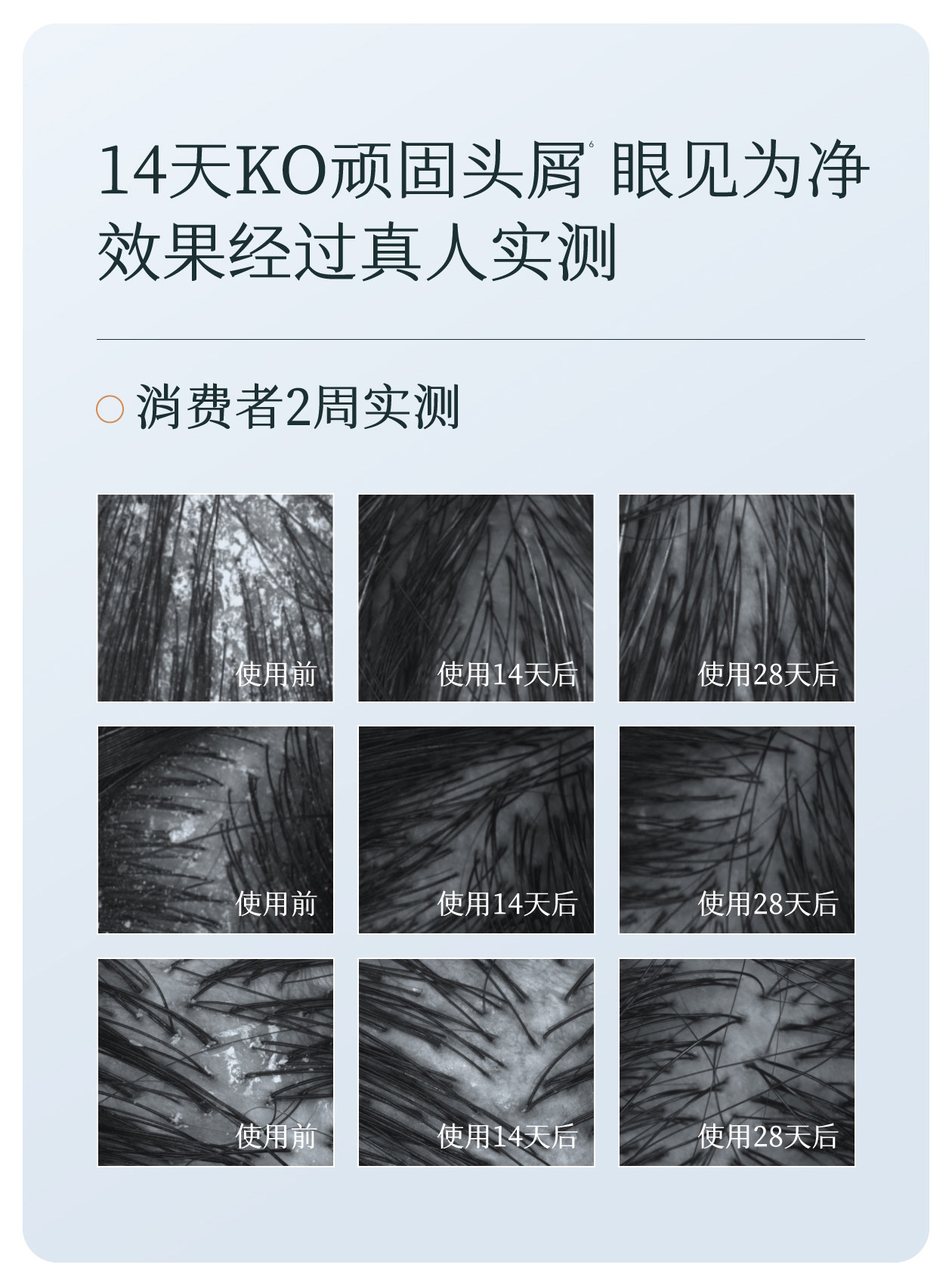 【中國直郵】 半畝花田 洗髮精 控油蓬鬆去屑止癢柔順改善乾枯毛躁 控油洗髮精 333g