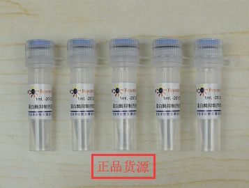经典 蛋白酶抑制剂混合物(His-Tag蛋白纯化用, 100X) P1031碧云天