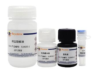 钙含量显色检测试剂盒    S1063S   200次  碧云天生物 Beyotime