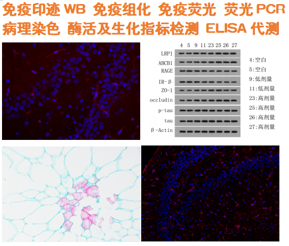 科研服务生化检测 ELSIA代测 WB 免疫组化/荧光 蛋白组学 PCR定量