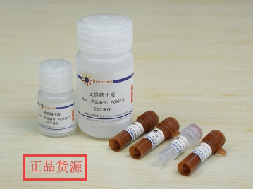 经典产品 科研专用 抗氟离子酸性磷酸酶检测试剂盒 P0335碧云天