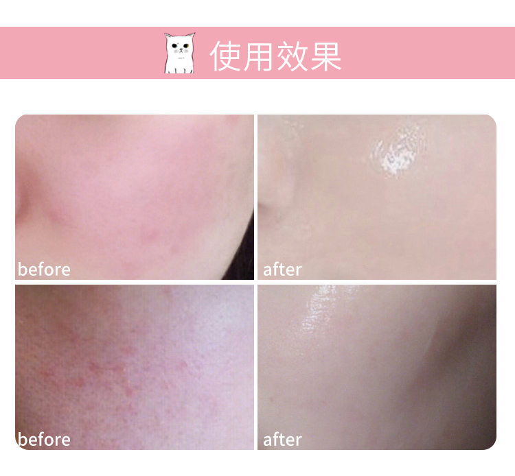 Kem dưỡng da mặt Shonan của Nhật Bản phẫu thuật thẩm mỹ ba trong một dưỡng ẩm nước dưỡng ẩm tinh chất 150 g kem mặt lớn - Kem dưỡng da kem làm trắng da mặt