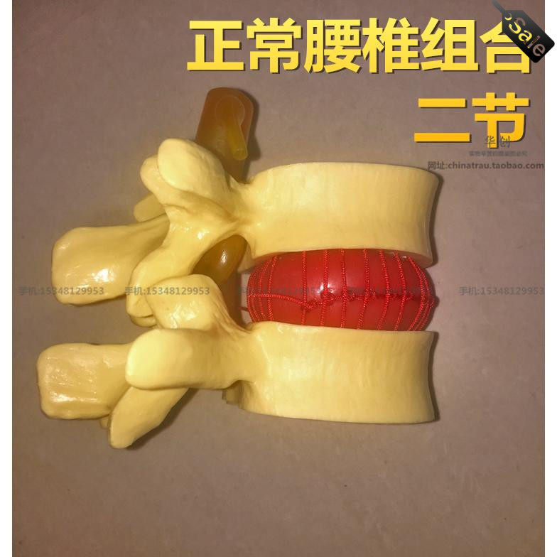 116正品医学腰椎正常组合模型椎间盘突出骨科教学骨骼模型二节