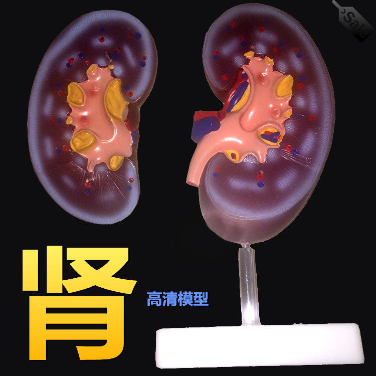 医用肾脏解剖模型人体医学肾球切面教学培训专用输尿管功能泌尿
