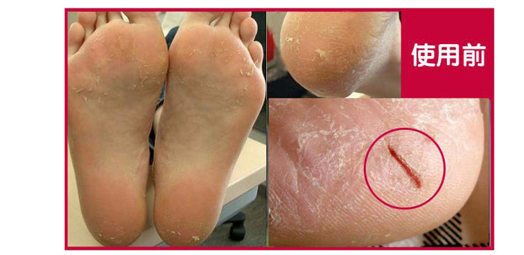 Chaussettes - collants 5 paires chargée - Ref 760952 Image 36