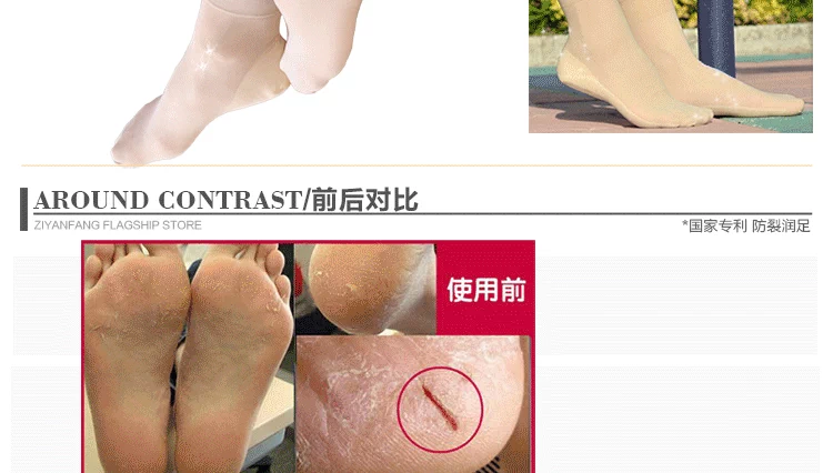 Ziyan chống nứt tất nữ vớ cao gót loại vớ mỏng chống chân khô chân nứt chân khô nứt nhung mùa hè mỏng tất xỏ ngón