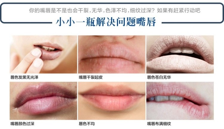 Anh Vaseline Vaseline Lip Balm Lip Mask 20g Dưỡng ẩm lột Môi Môi Gửi Lip Brush - Son môi black rouge a30