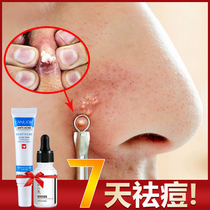 Lanoer acne desalination cream acne acne acne Li Jiaqi recommended Qi female men non-repair artifact