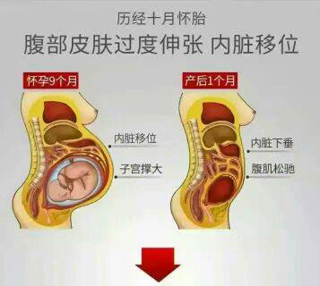 Corset amincissant - Ref 685720 Image 8