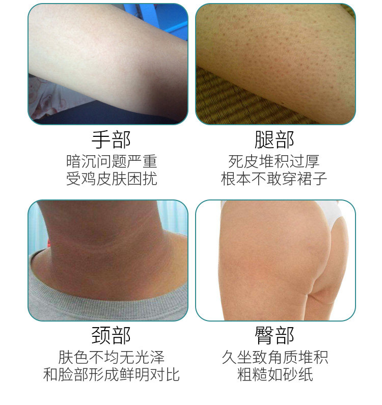 Tẩy tế bào chết Gel tẩy tế bào chết cho da mặt Làm trắng da toàn thân Giữ ẩm cho mụn đầu đen và phụ nữ nhẹ nhàng tẩy tế bào chết tẩy tế bào chết ngọc trai