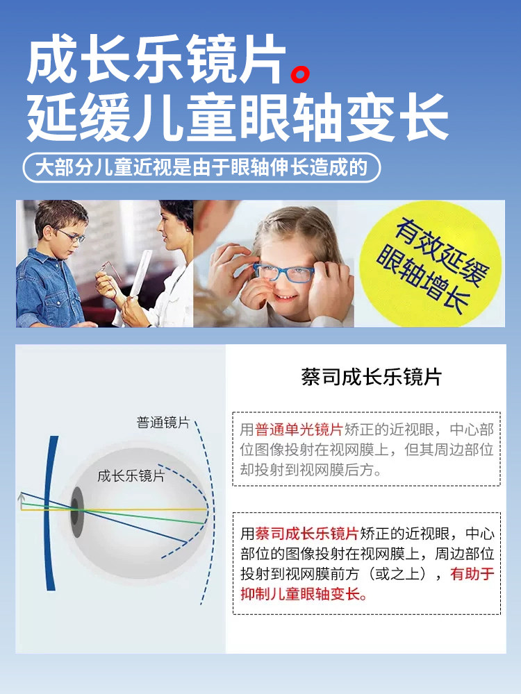 Zeiss Children's Growth Platinum Film Lotus Film Focus-Reducing Myopia Prevention Enhanced Edition Student Glasses