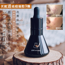 Rookie and formulator facial essence muscle base liquid Black gold three bottles of Curcumin acne improvement and lightening acne 30ml