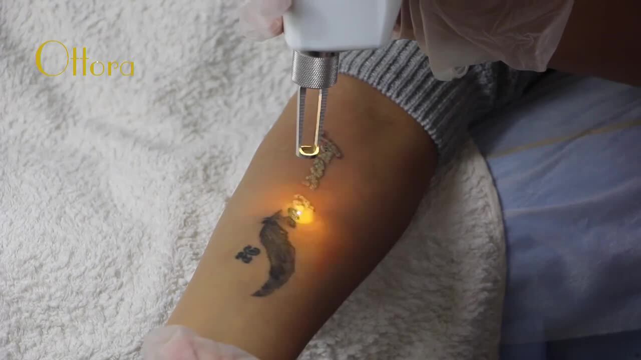 2000mj Energy Dual Yellow Laser Rods Tattoo Removal 1320nm 1064nm 532nm