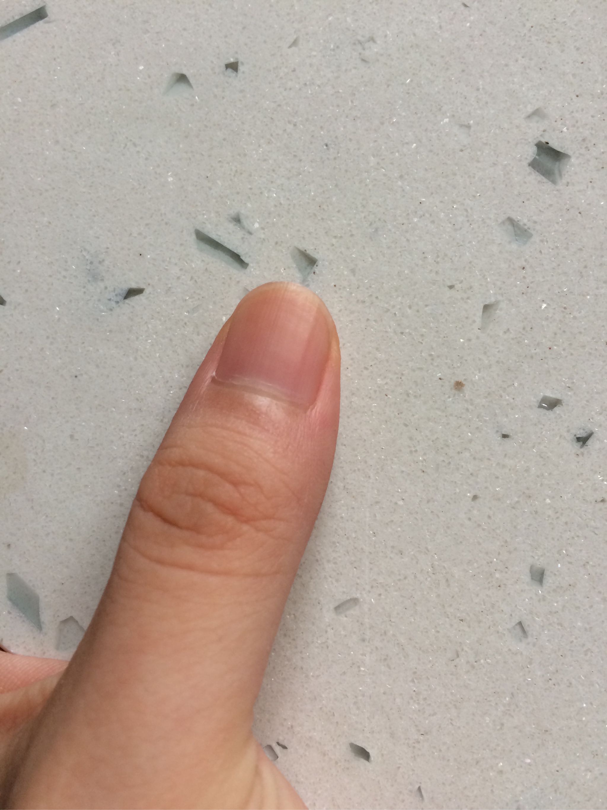 小麦胚芽精华 VE死皮软化剂好不好用，是什么牌子,第7张